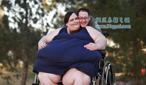 世界上最肥的人，苏珊娜埃曼破1450斤还想增沉