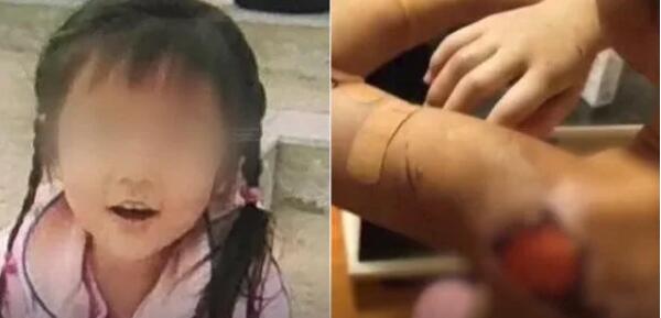 8岁女童遭亲爸后妈猖獗残害 民警干笔录时忍没有住大哭