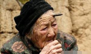 百岁老翁头上长“犄角”之谜，预见癌症病变_皮肤肿瘤